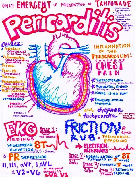 Help Me Pass Nursing School Ask Me Anything Nursing School Notes