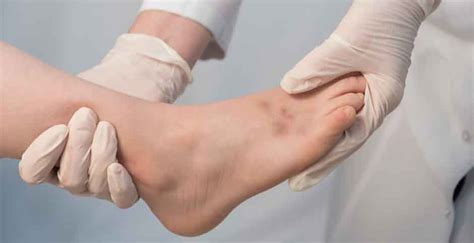 Understanding And Treating A Sprained Big Toe Causes Symptoms And