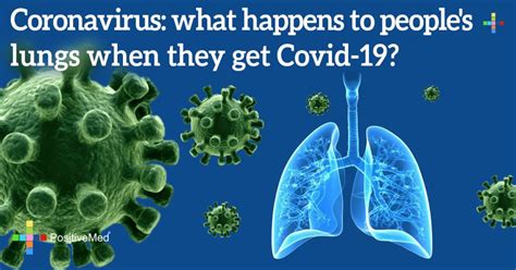 Help prevent the spread of respiratory diseases, like coronavirus disease 2019. Coronavirus: What Happens to People's Lungs When They Get ...
