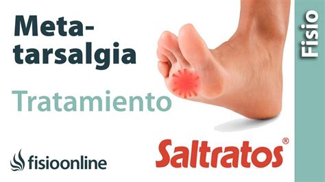 Metatarsalgia En Deportistas Cómo Prevenir Y Tratar El Dolor En Los Pies