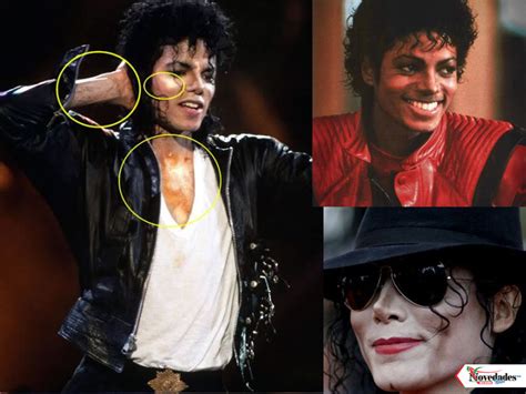 ¿cómo Le Hizo Michael Jackson Para Hacerse De Piel Blanca Novedades News