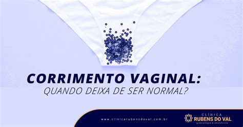 Corrimento Vaginal o que é e sintomas Clínica Rubens do Val CRM 58764