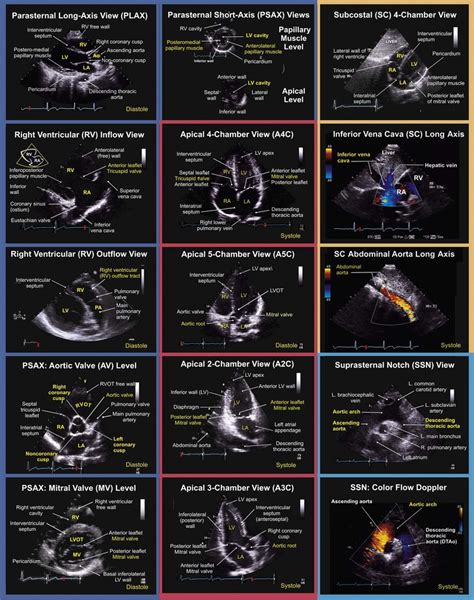 Pocus Echocardiography Table Of Cardiac Views And Windows