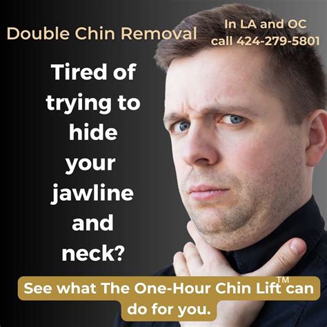 Double Chin Removal The One Hour Chin Lift Alc