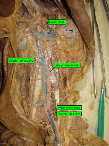 Differentiate among the structure of arteries, veins, and capillaries. Major Arteries and Veins of the Cat | Anatomy Corner