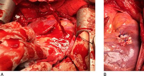 Penetrating Injury To The Cardiac Box And The Deadly Dozen Bmj Case