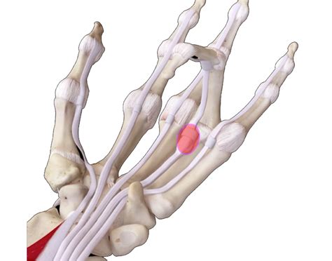 Trigger Finger Causes Symptoms And Treatments Orthopaedics Corner