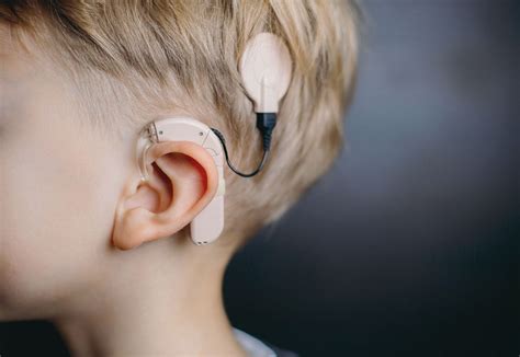Optogenetik Neues Cochlea Implantat Soll Das Hören Verbessern
