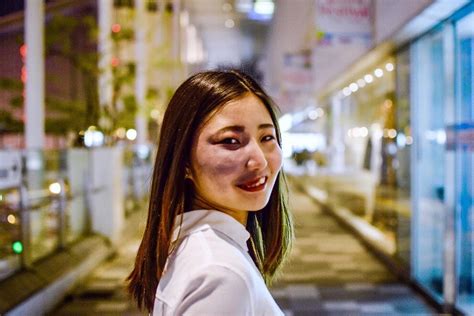 21 yr old instagrammer with facial birthmark challenging japan s appearance biases the mainichi