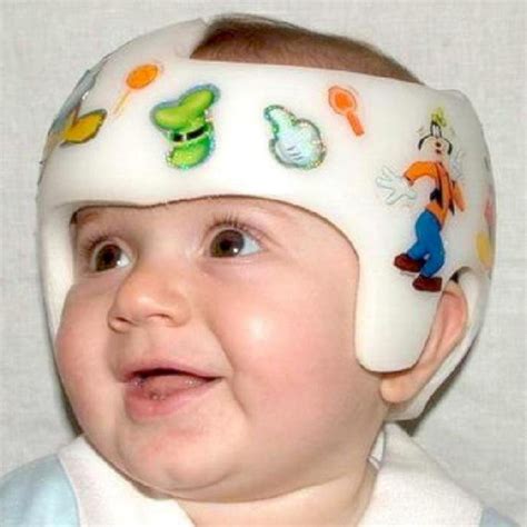 Plagiocefalia cuando el bebé tiene la cabeza plana o deformada Bebé