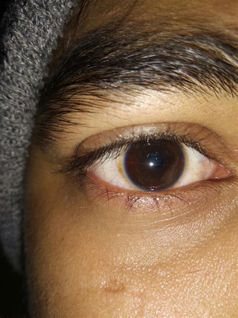 Are My Eyes Ugly Male 20 Reyes