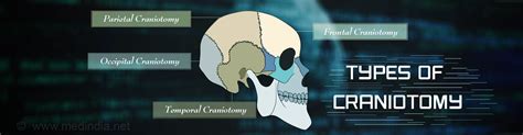 Craniotomy Types Indications Procedure Complications