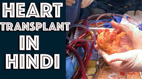 Heart Transplant Explained In Hindi Medical Guruji Youtube