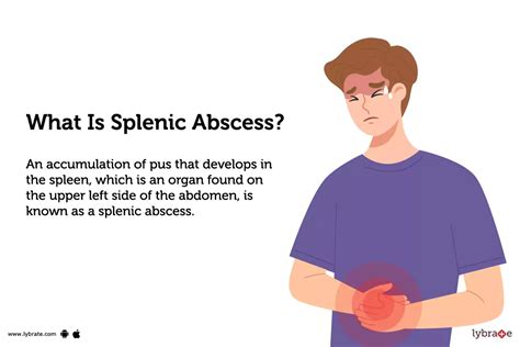 Splenic Abscess Causes Symptoms Treatment And Cost