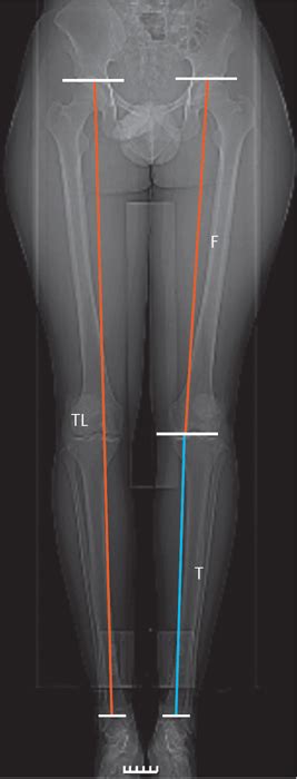 Knee Anatomy X Ray