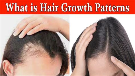 What Is Hair Growth Pattern By Jas Sir From Sam And Jas Hair And Make Up