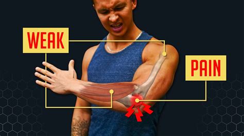 How To Fix Elbow Pain Bulletproof Your Elbows Youtube
