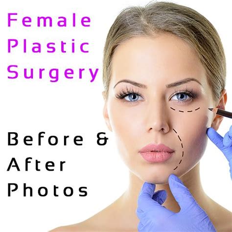 Pin On Female Celebrity Plastic Surgery