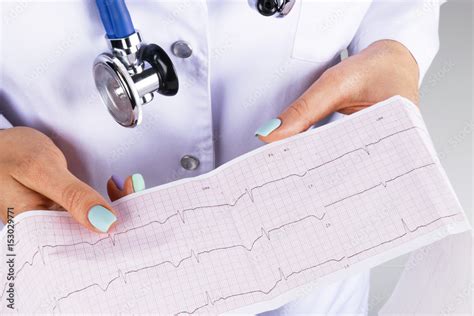 Electrocardiogram Ecg In Hand Of A Female Doctor Medical Health Care