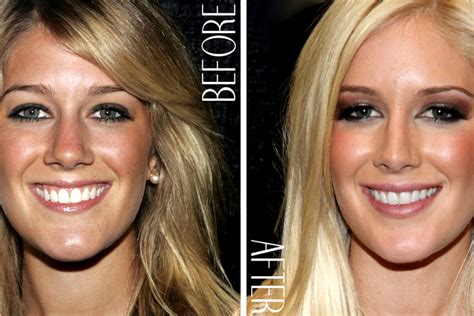 10 Shocking Celebrity Transformations