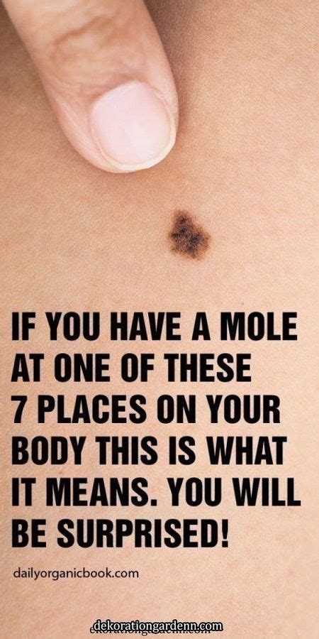 If You Have A Mole At One Of These Places On Your Body This Is What It