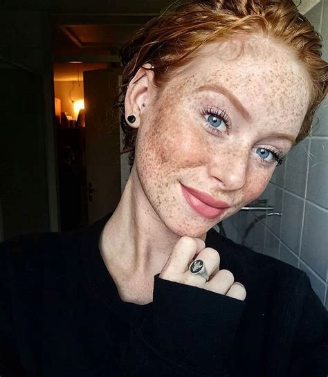 Daily Timewaster Freckles They Are Good