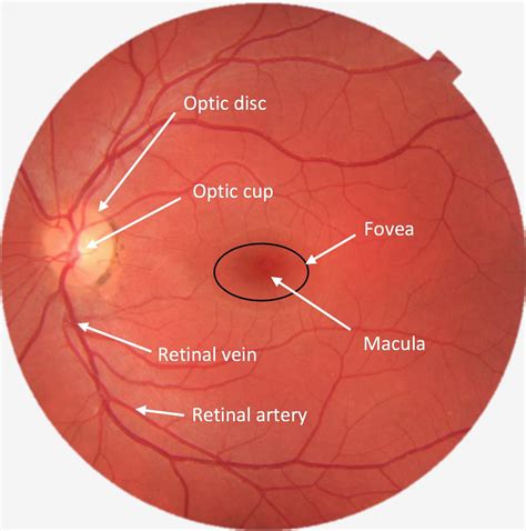 Eye Examination And Fundoscopy Ophthalmoscopy Station Osce