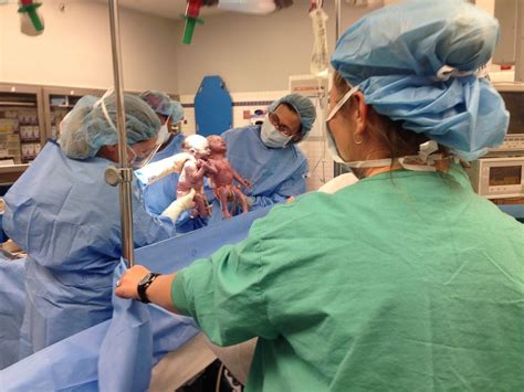 rare set of twins hold hands in delivery room abc news