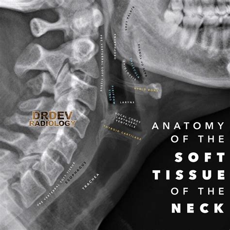 Lateral Neck X Ray Soft Tissue Anatomy Dr Devpriyo Grepmed