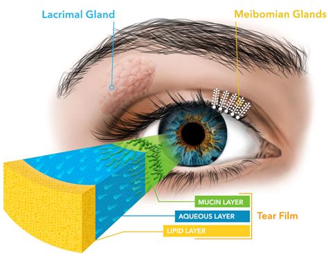 Dry Eye Management Discovery Optometry