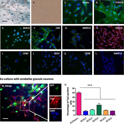Phenotypic Characterization Of Neural Crest Derived Cells Isolated From