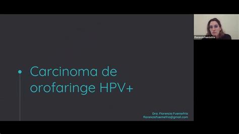 1582023 Carcinoma De Orofaringe Hpv Positivo Youtube