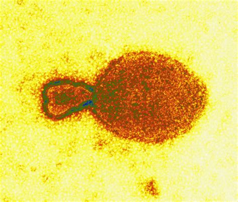 Human Trials For New Hendra Virus Antibody Cosmos Magazine