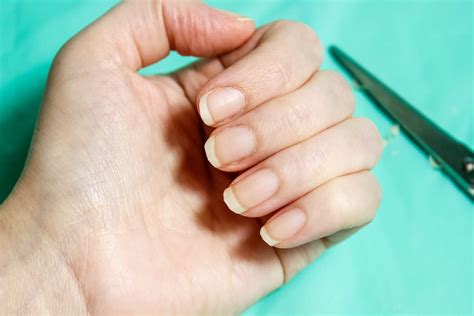 How To Fix Crooked Nails Complete Guide