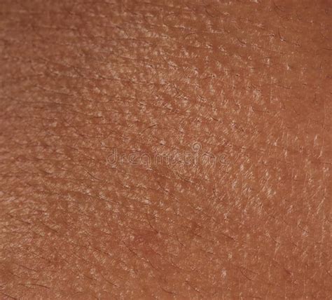 Human Skin Texture Stock Image Image Of Texture Dermatology
