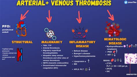 Causes Of Arterial And Venous Thrombosis Differential Grepmed