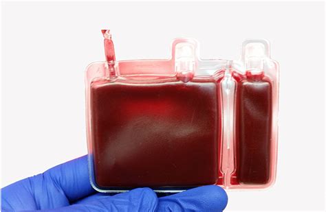 Cryo Cell Intl Launches New Five Chamber Cord Blood Storage Bag