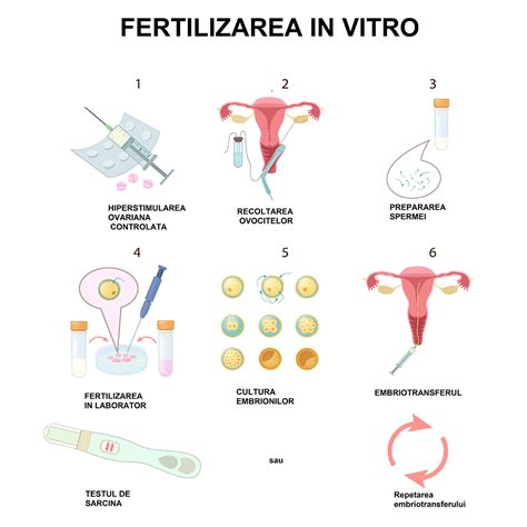 Tehnici De Reproducere Umana Asistata Fertilizarea In Vitro Fiv