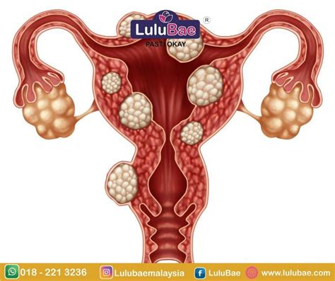Kesuburan seorang wanita ditandai dengan adanya proses ovulasi serta sel telur yang telah siap untuk proses pembuahan. Sebab Period Lambat Datang Walau Tak Hamil - Lulubae