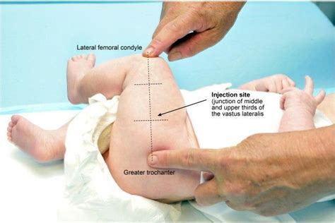 Intramuscular Im Injection Site In Neonates Thigh Vastus Lateralis Pediatric Nursing