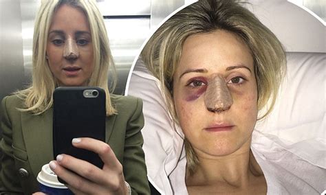 Roxy Jacenko Tells Kyle And Jackie O She Won T See Nose Job Results For