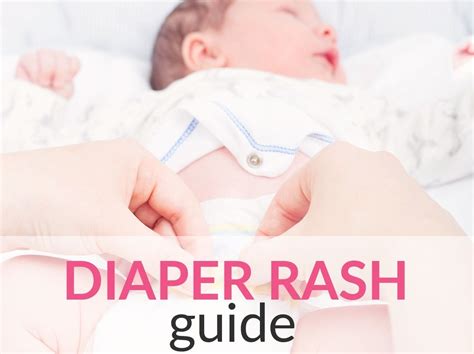 Diaper Rash Guide Symptoms Causes And Effective Remedies For Your Baby