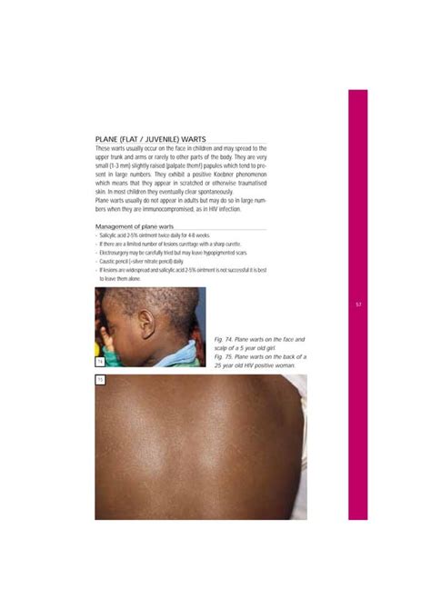 Common Skin Diseases In Africa Illustrated Guide 2001pdf
