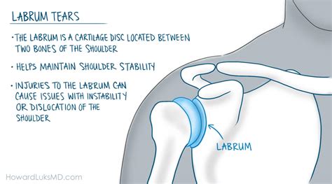 Serious Shoulder Injuries When Should I See A Doctor
