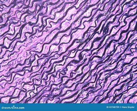 Elastic Tissue Seen Through A Microscope Stock Image Image Of Fibers