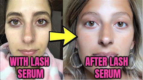 However, if you want to benefit from. WHAT HAPPENS AFTER LASH SERUM? I'M HERE TO TELL YOU ...