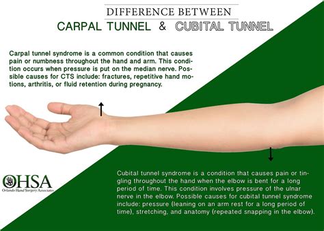 Orlando Hand Surgery On Twitter Learn About Cubital Tunnel Syndrome