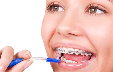La Importancia De Recurrir A La Ortodoncia Dental Cuando Es Necesaria