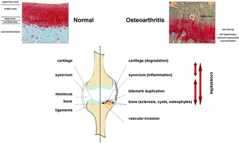 Basic Science Of Osteoarthritis Journal Of Experimental Orthopaedics
