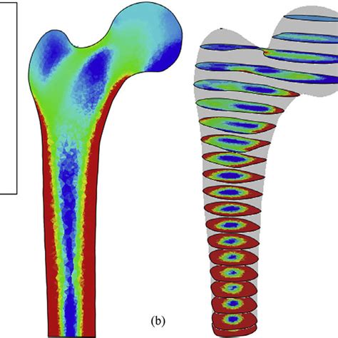 Bone Volume Distribution For The Intact Femur Model A